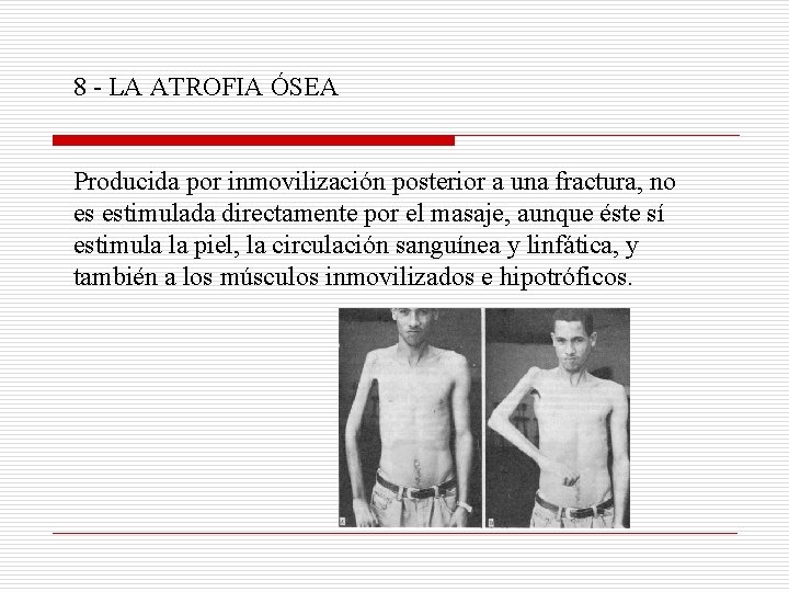 8 - LA ATROFIA ÓSEA Producida por inmovilización posterior a una fractura, no es