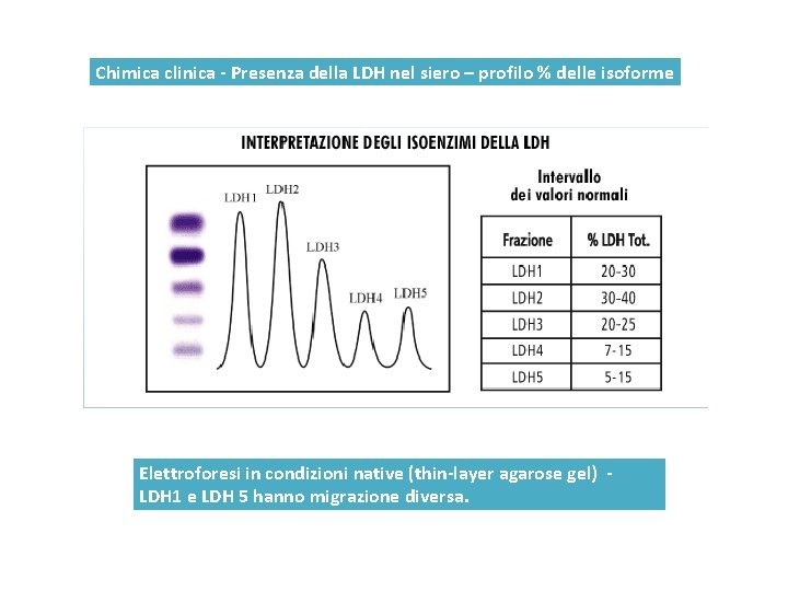 Chimica clinica - Presenza della LDH nel siero – profilo % delle isoforme Elettroforesi