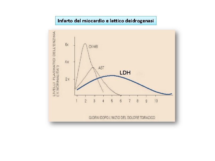 Infarto del miocardio e lattico deidrogenasi LDH 