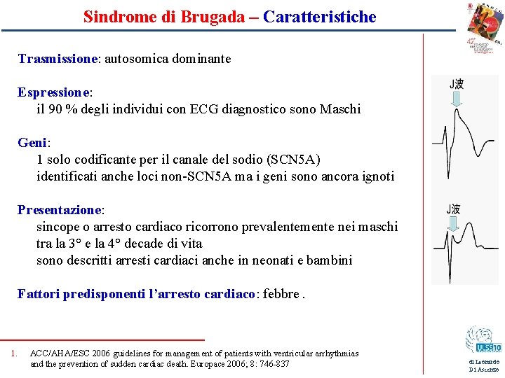 Sindrome di Brugada – Caratteristiche Trasmissione: autosomica dominante Espressione: il 90 % degli individui