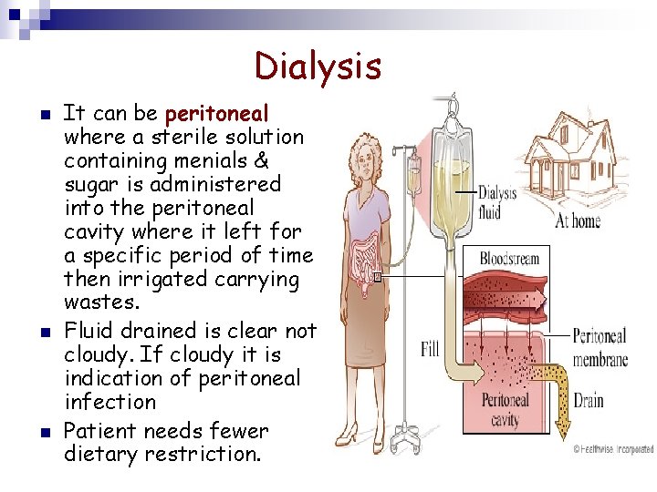 Dialysis n n n It can be peritoneal where a sterile solution containing menials