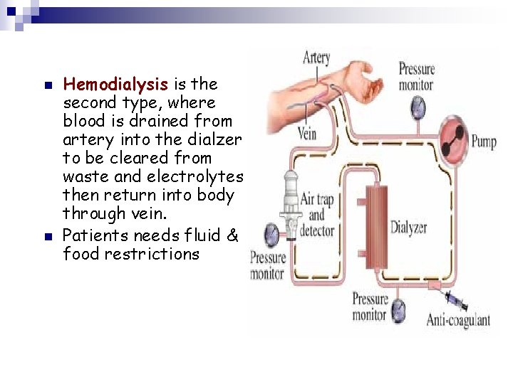 n n Hemodialysis is the second type, where blood is drained from artery into