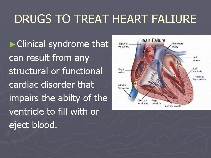 DRUGS TO TREAT HEART FALIURE ► Clinical syndrome that can result from any structural