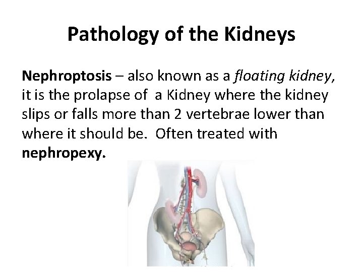 Pathology of the Kidneys Nephroptosis – also known as a floating kidney, it is