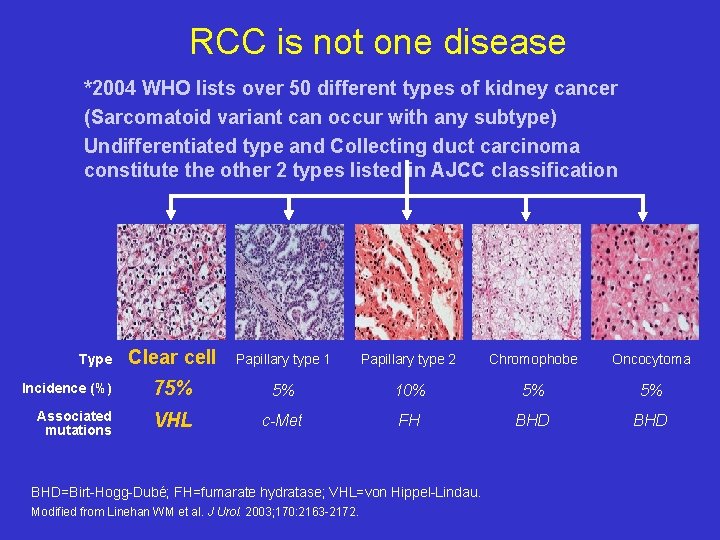 RCC is not one disease *2004 WHO lists over 50 different types of kidney