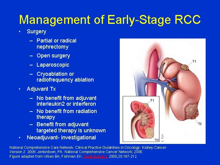 Management of Early-Stage RCC • Surgery – Partial or radical nephrectomy – Open surgery