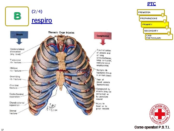 PTC (2/4) respiro PREMESSA PREPARAZIONE PRIMARY SECONDARY CASI PARTICOLARI 27 Corso operatori P. S.