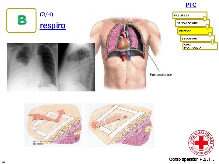 PTC (3/4) respiro PREMESSA PREPARAZIONE PRIMARY SECONDARY CASI PARTICOLARI 28 Corso operatori P. S.