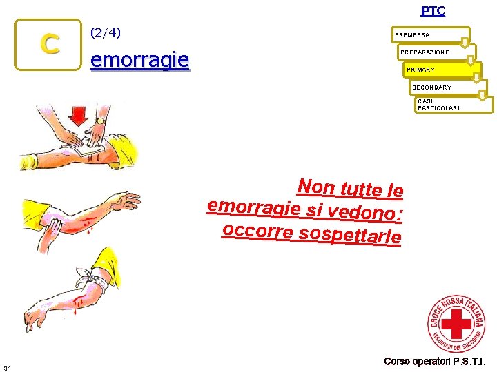 PTC (2/4) emorragie PREMESSA PREPARAZIONE PRIMARY SECONDARY CASI PARTICOLARI Non tutte le emorragie si