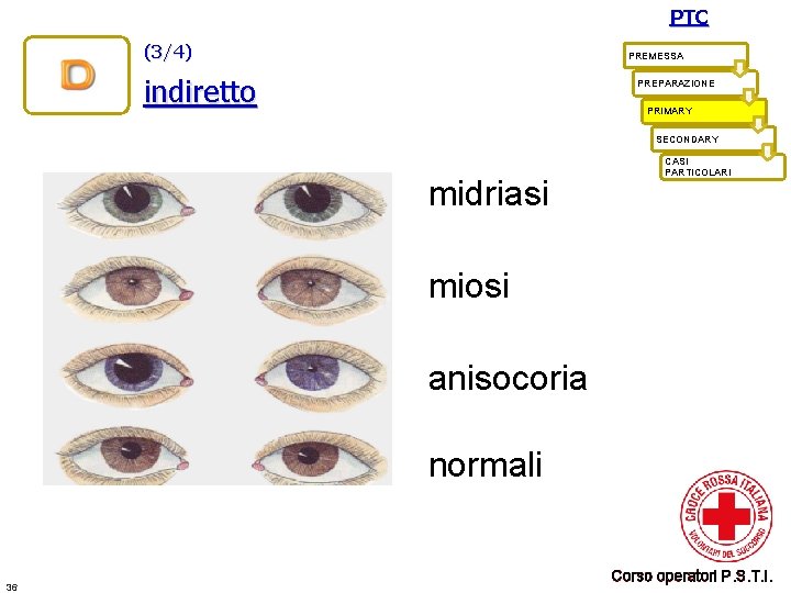 PTC (3/4) PREMESSA indiretto PREPARAZIONE PRIMARY SECONDARY midriasi CASI PARTICOLARI miosi anisocoria normali 36