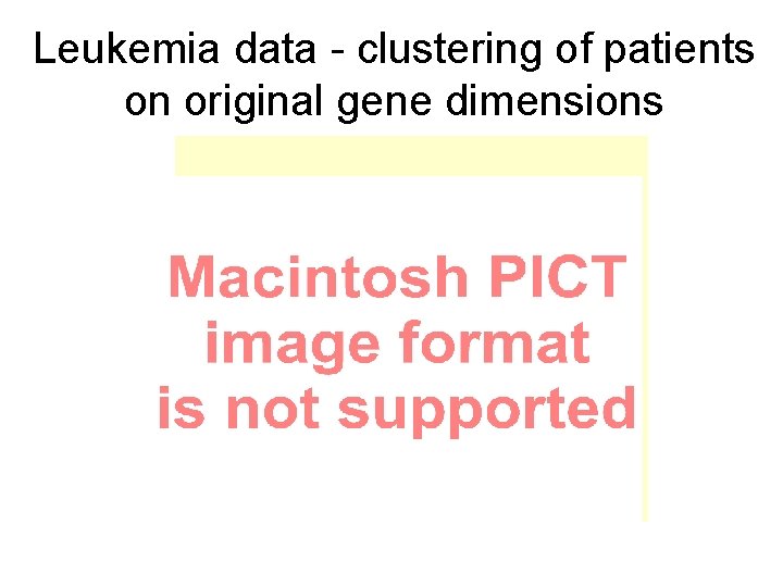 Leukemia data - clustering of patients on original gene dimensions 