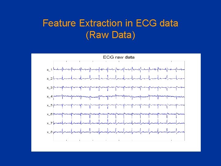 Feature Extraction in ECG data (Raw Data) 