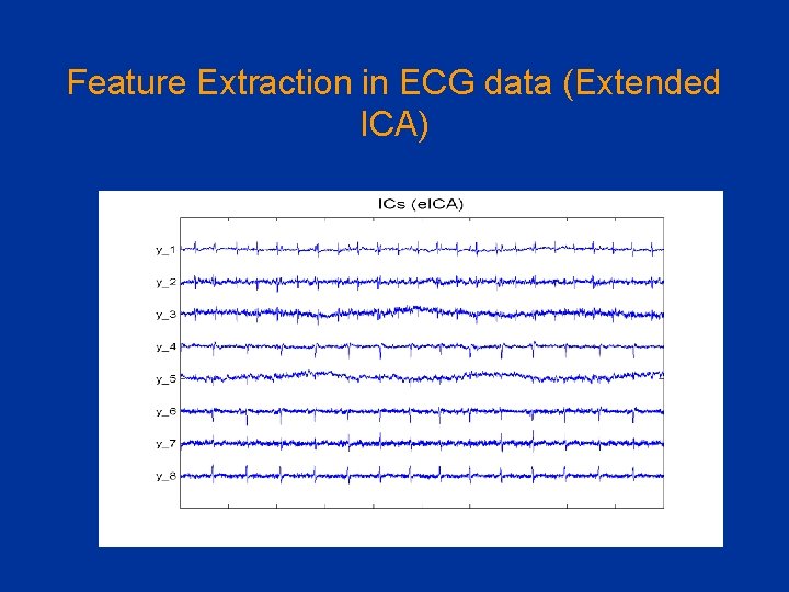 Feature Extraction in ECG data (Extended ICA) 