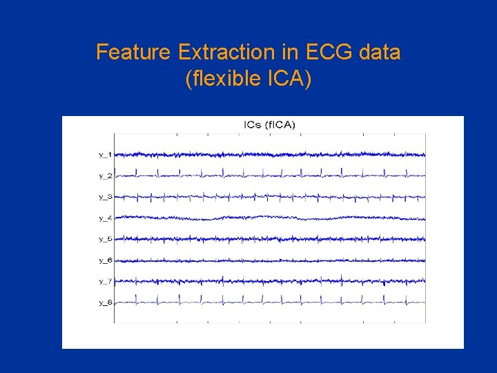 Feature Extraction in ECG data (flexible ICA) 