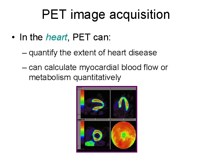 PET image acquisition • In the heart, PET can: – quantify the extent of