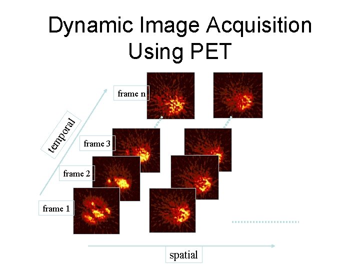 Dynamic Image Acquisition Using PET tem po ral frame n frame 3 frame 2