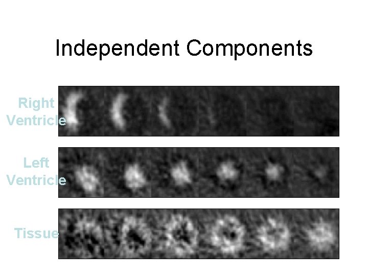 Independent Components Right Ventricle Left Ventricle Tissue 