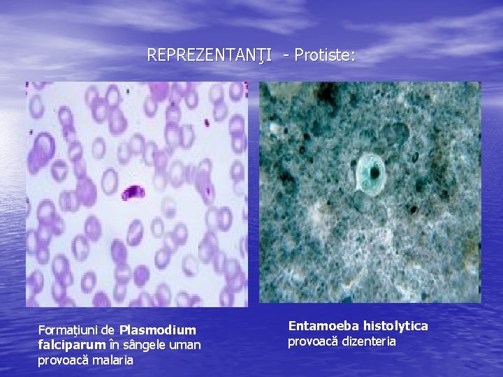 REPREZENTANŢI - Protiste: Formaţiuni de Plasmodium falciparum în sângele uman provoacă malaria Entamoeba histolytica