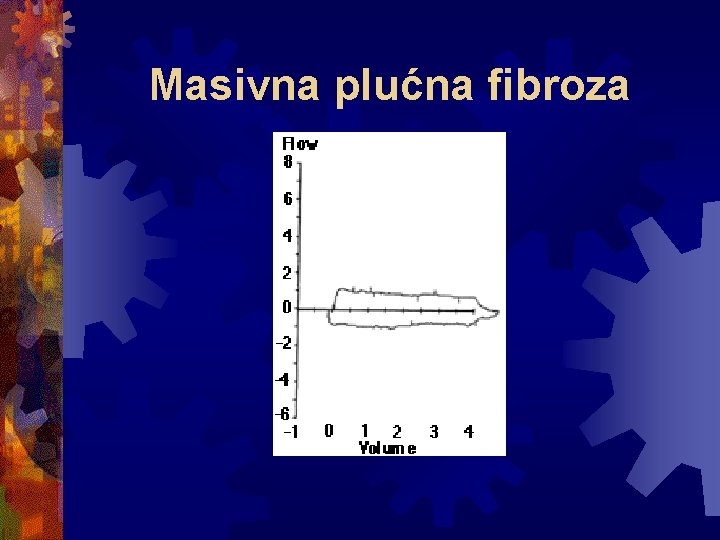 Masivna plućna fibroza 