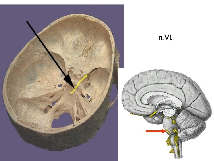 n. VI. 