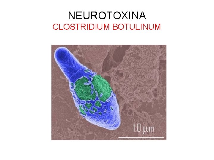 NEUROTOXINA CLOSTRIDIUM BOTULINUM 