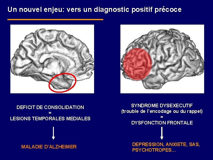 Un nouvel enjeu: vers un diagnostic positif précoce DEFICIT DE CONSOLIDATION = LESIONS TEMPORALES