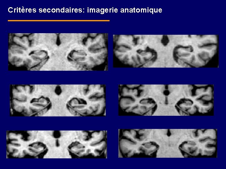 Critères secondaires: imagerie anatomique 