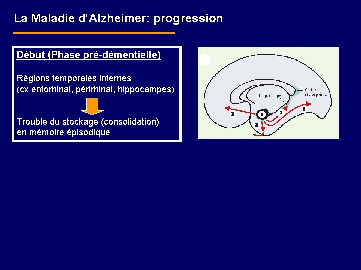 La Maladie d’Alzheimer: progression Début (Phase pré-démentielle) Régions temporales internes (cx entorhinal, périrhinal, hippocampes)