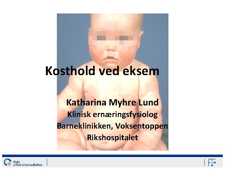 Kosthold ved eksem Katharina Myhre Lund Klinisk ernæringsfysiolog Barneklinikken, Voksentoppen Rikshospitalet 