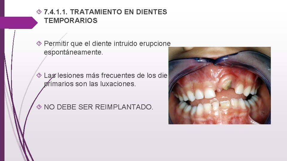  7. 4. 1. 1. TRATAMIENTO EN DIENTES TEMPORARIOS Permitir que el diente intruido