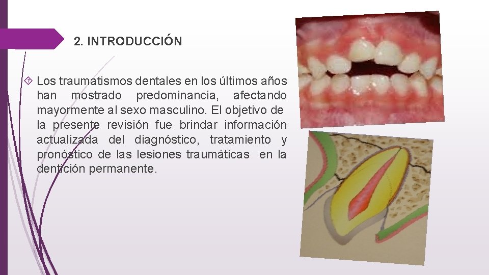  2. INTRODUCCIÓN Los traumatismos dentales en los últimos años han mostrado predominancia, afectando