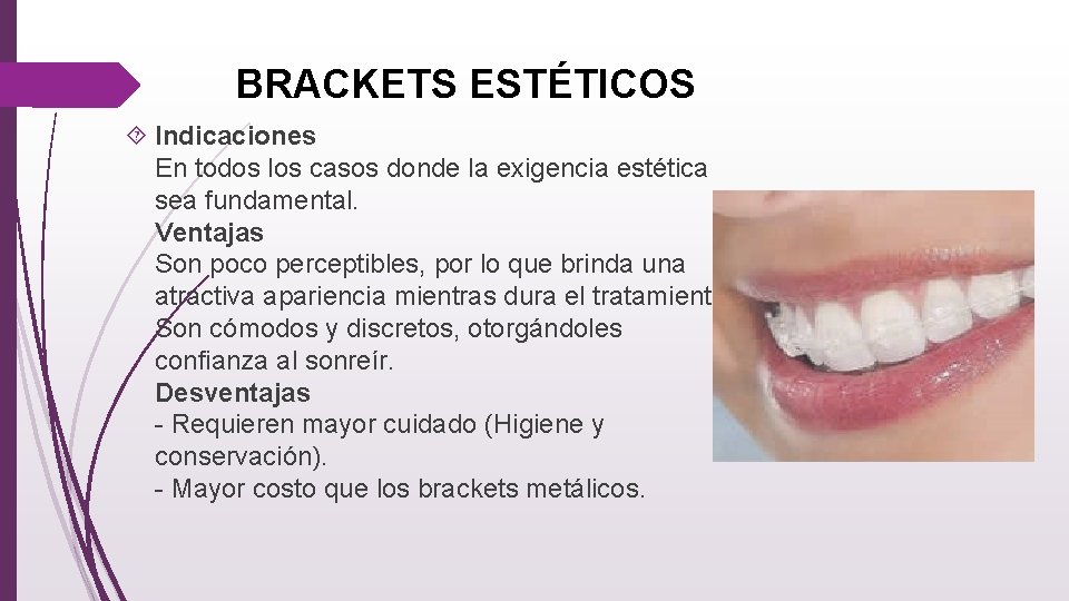 BRACKETS ESTÉTICOS Indicaciones En todos los casos donde la exigencia estética sea fundamental. Ventajas