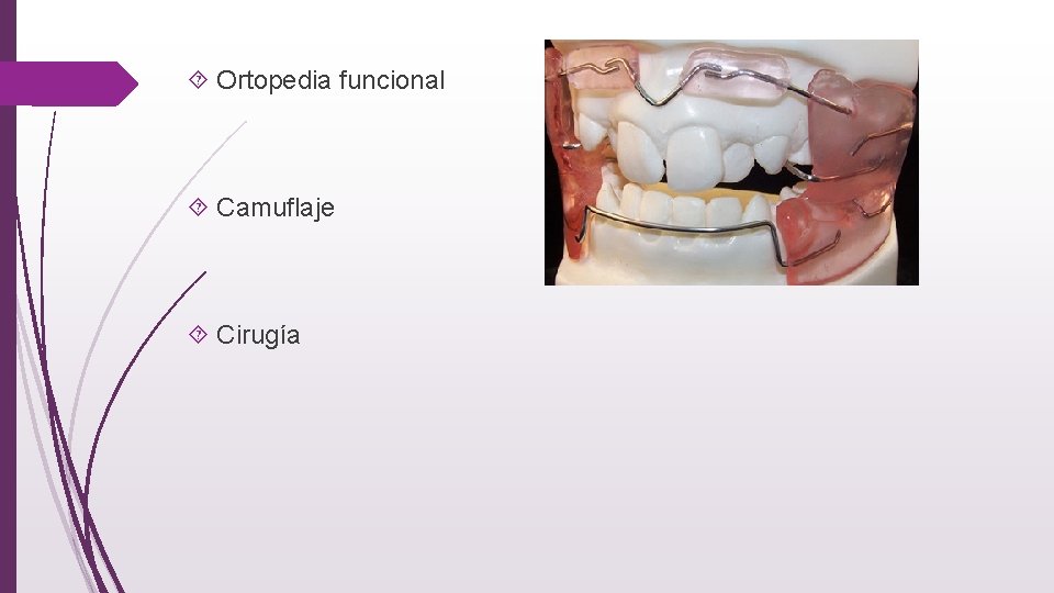  Ortopedia funcional Camuflaje Cirugía 
