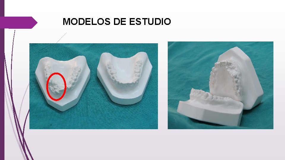 MODELOS DE ESTUDIO 