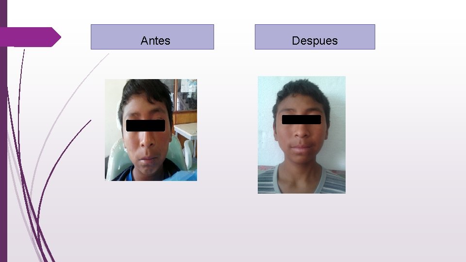  Antes Despues 