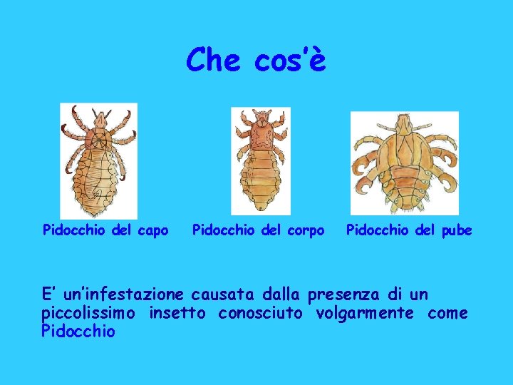 Che cos’è Pidocchio del capo Pidocchio del corpo Pidocchio del pube E’ un’infestazione causata