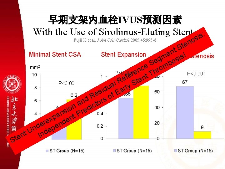早期支架内血栓IVUS预测因素 With the Use of Sirolimus-Eluting Stents is: Fujii K et al. J Am