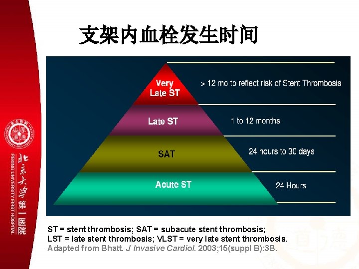 支架内血栓发生时间 ST = stent thrombosis; SAT = subacute stent thrombosis; LST = late stent
