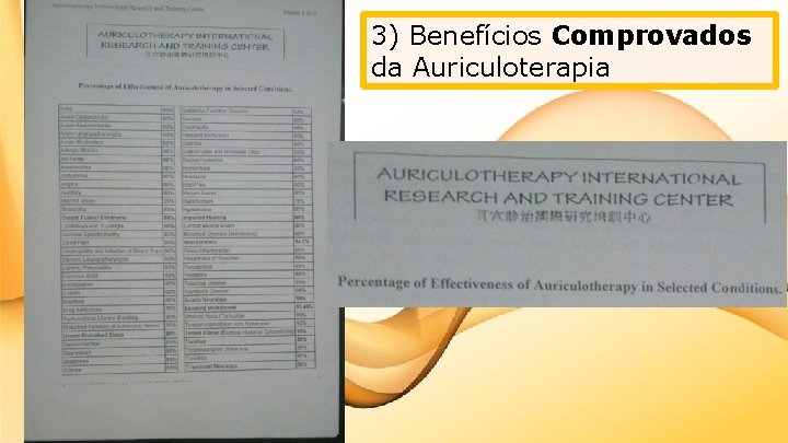 3) Benefícios Comprovados da Auriculoterapia 