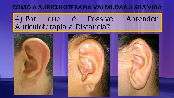 COMO A AURICULOTERAPIA VAI MUDAR A SUA VIDA 4) Por que é Possível Auriculoterapia