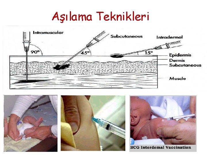 Aşılama Teknikleri 