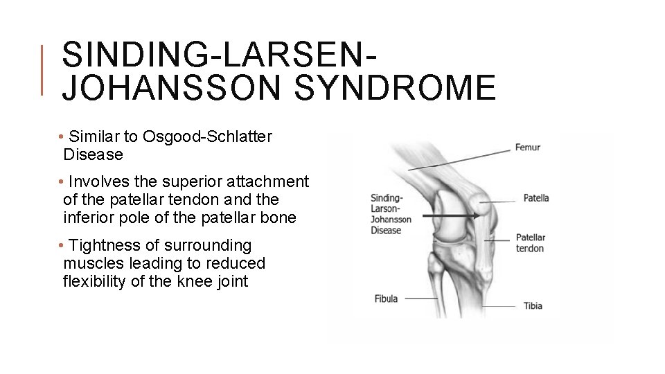 SINDING-LARSENJOHANSSON SYNDROME • Similar to Osgood-Schlatter Disease • Involves the superior attachment of the SINDING-LARSENJOHANSSON SYNDROME • Similar to Osgood-Schlatter Disease • Involves the superior attachment of the