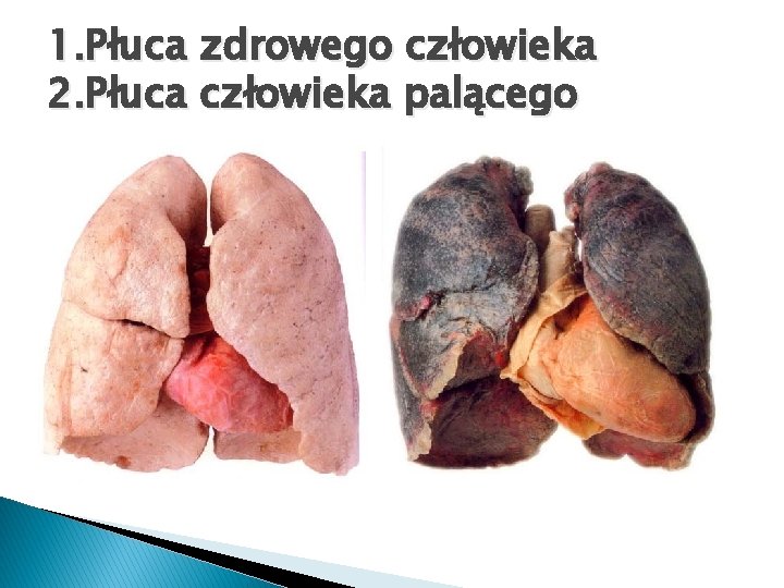 1. Płuca zdrowego człowieka 2. Płuca człowieka palącego 