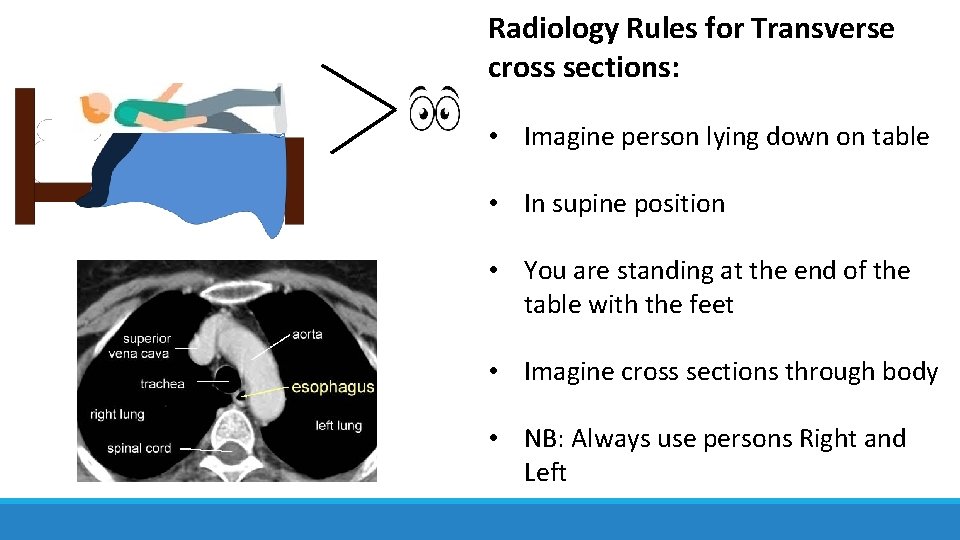 Radiology Rules for Transverse cross sections: • Imagine person lying down on table • Radiology Rules for Transverse cross sections: • Imagine person lying down on table •