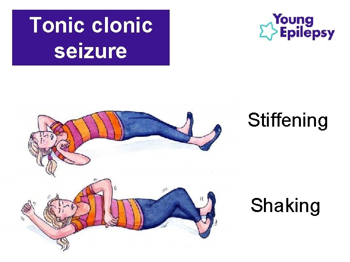Tonic clonic seizure Stiffening Shaking 
