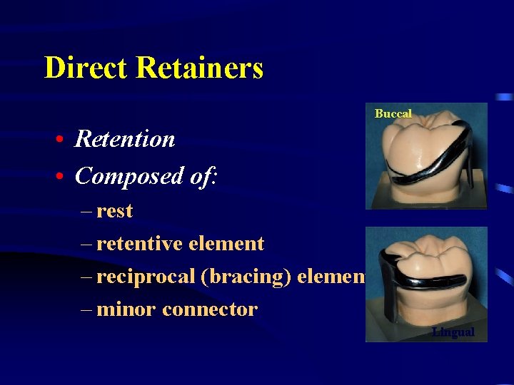 Direct Retainers Buccal • Retention • Composed of: – rest – retentive element –