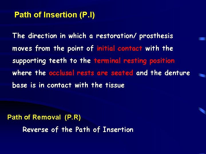 Path of Insertion (P. I) The direction in which a restoration/ prosthesis moves from