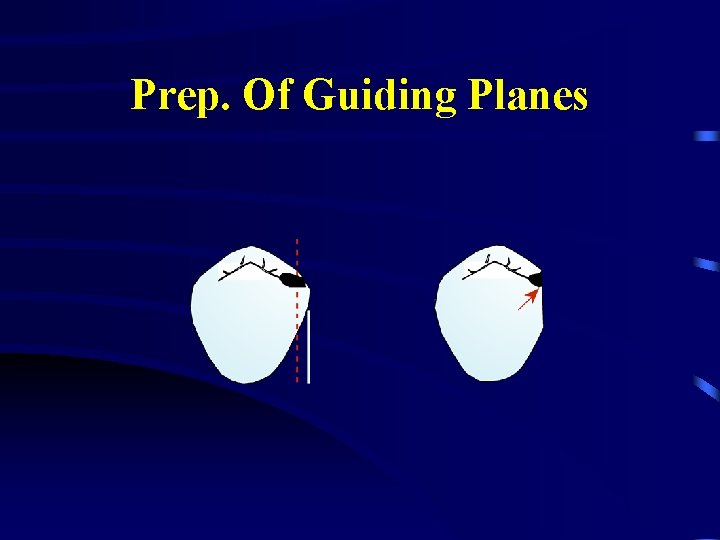 Prep. Of Guiding Planes 