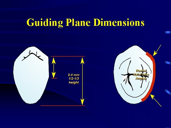 Guiding Plane Dimensions 