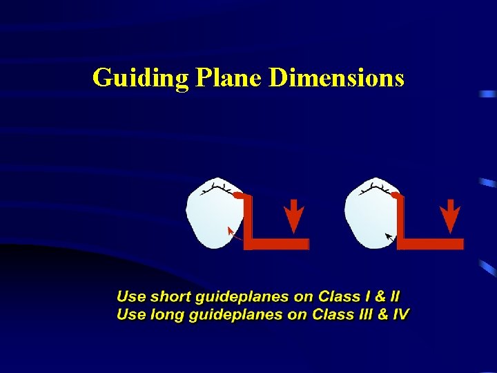 Guiding Plane Dimensions 